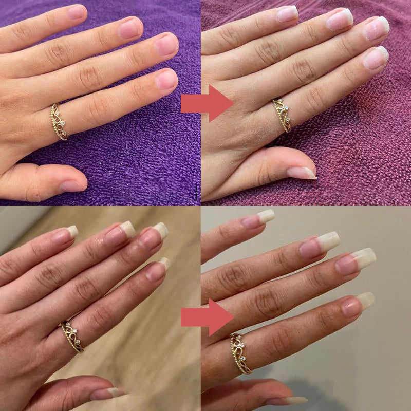 Nails Nutritious Growth Oil - Image 14