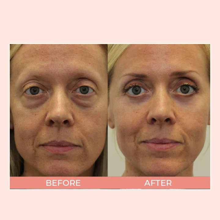 Retinol Eye Cream Stick🔥🔥BUY 2 GET 1 FREE - Image 6